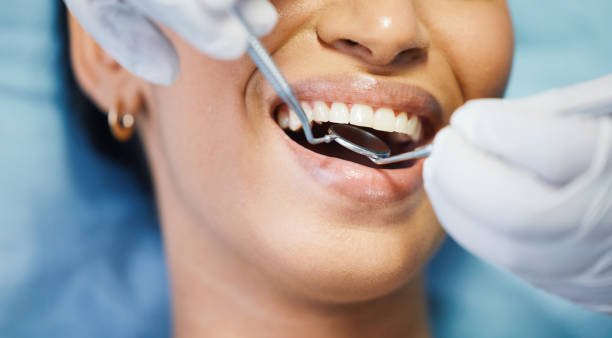 Best Chipped Tooth Repair Near Me  in Cypress Landing, NC